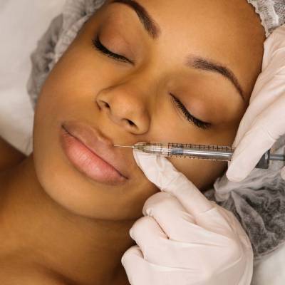 FACIAL FILLERS